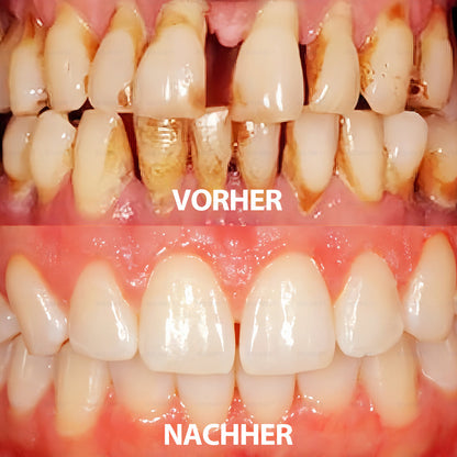 ✅ Hergestellt und versendet aus Deutschland | Rolimey® Transforming Growth Factor-β (TGF-β) Mundspülung zur oralen Reparatur❤️❤️