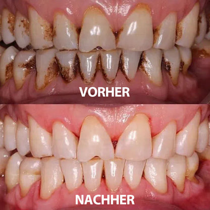 ✅ Hergestellt und versendet aus Deutschland | Rolimey® Transforming Growth Factor-β (TGF-β) Mundspülung zur oralen Reparatur❤️❤️