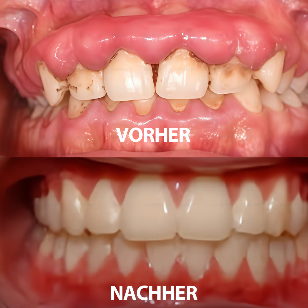✅ Hergestellt und versendet aus Deutschland | Rolimey® Transforming Growth Factor-β (TGF-β) Mundspülung zur oralen Reparatur❤️❤️