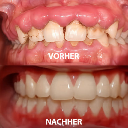 ✅ Hergestellt und versendet aus Deutschland | Rolimey® Transforming Growth Factor-β (TGF-β) Mundspülung zur oralen Reparatur❤️❤️